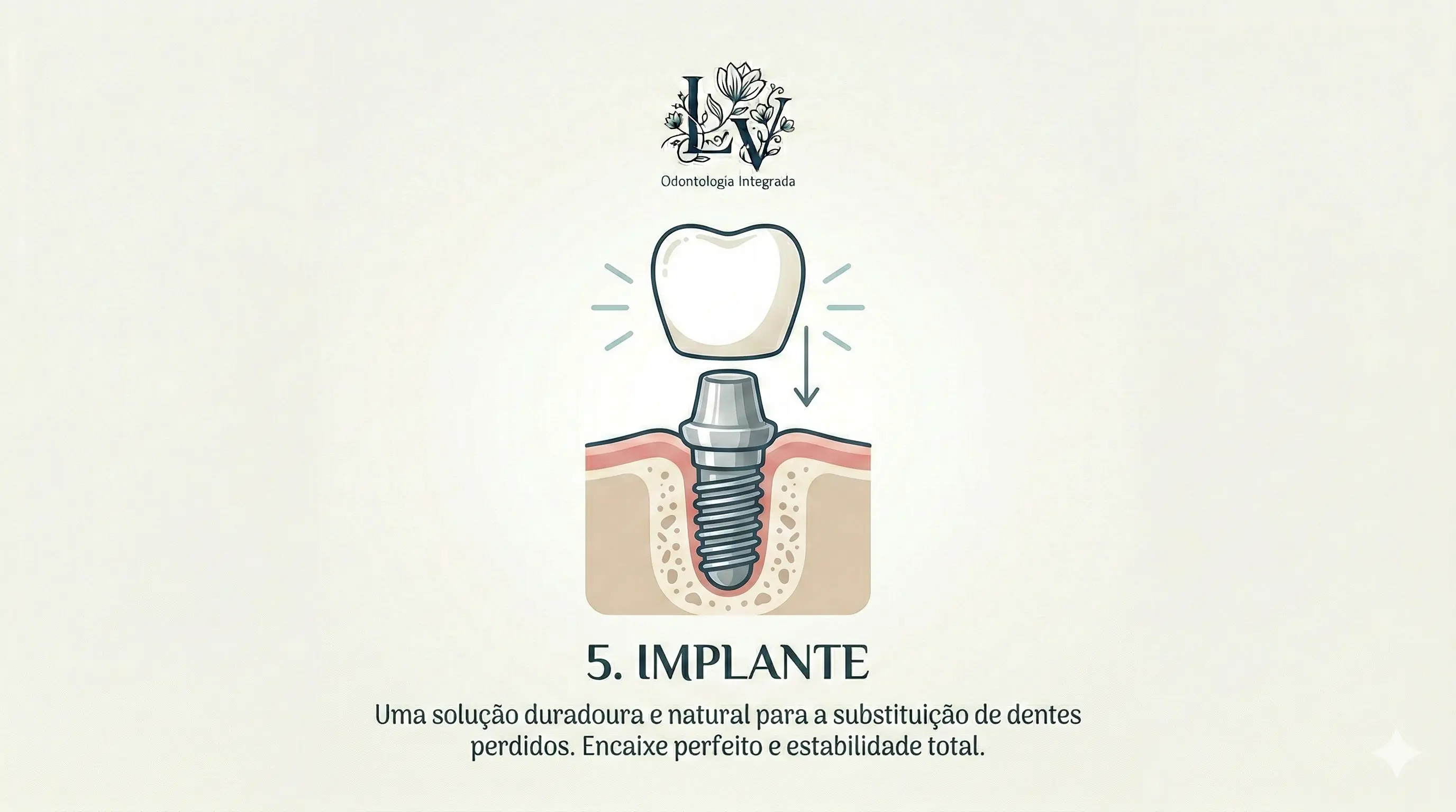 Implante